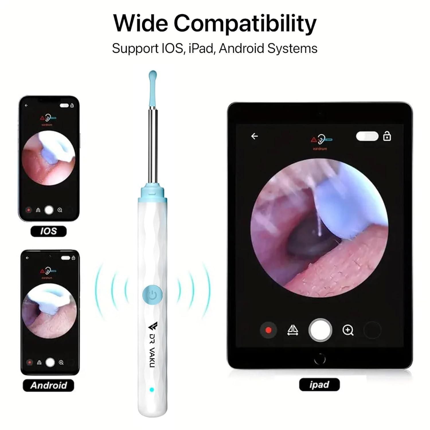 Smart Visual Ear Wax Cleaner new1wu-ts