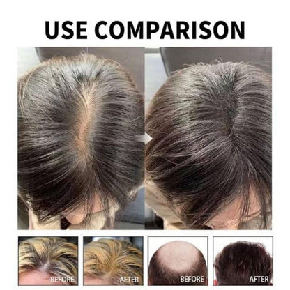 Hair Loss Treatment Serum 30Ml (Pack Of 2) new1wu-ts