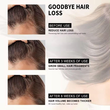 Hair Loss Treatment Serum 30Ml (Pack Of 2) new1wu-ts