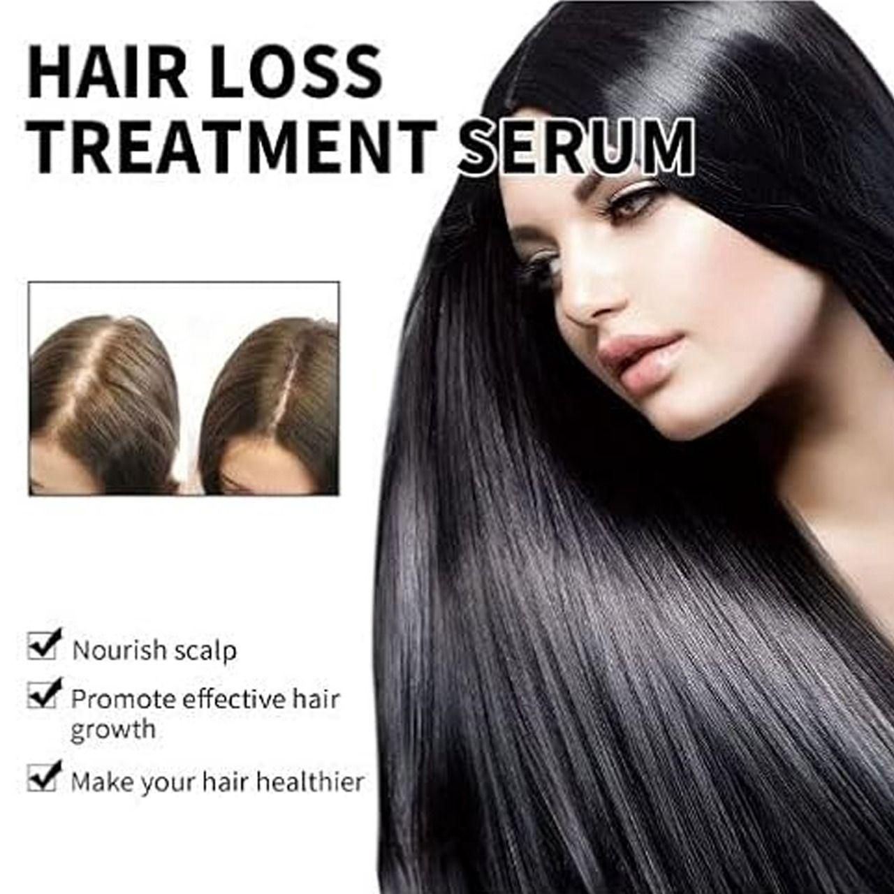 Hair Loss Treatment Serum 30Ml (Pack Of 2) new1wu-ts