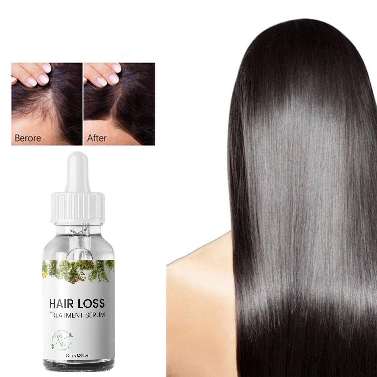 Hair Loss Treatment Serum 30Ml (Pack Of 2) new1wu-ts