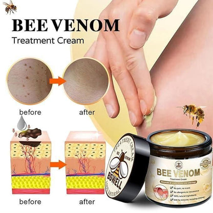 Bee Venom Skin Treatment Cream 100g Orrizon India